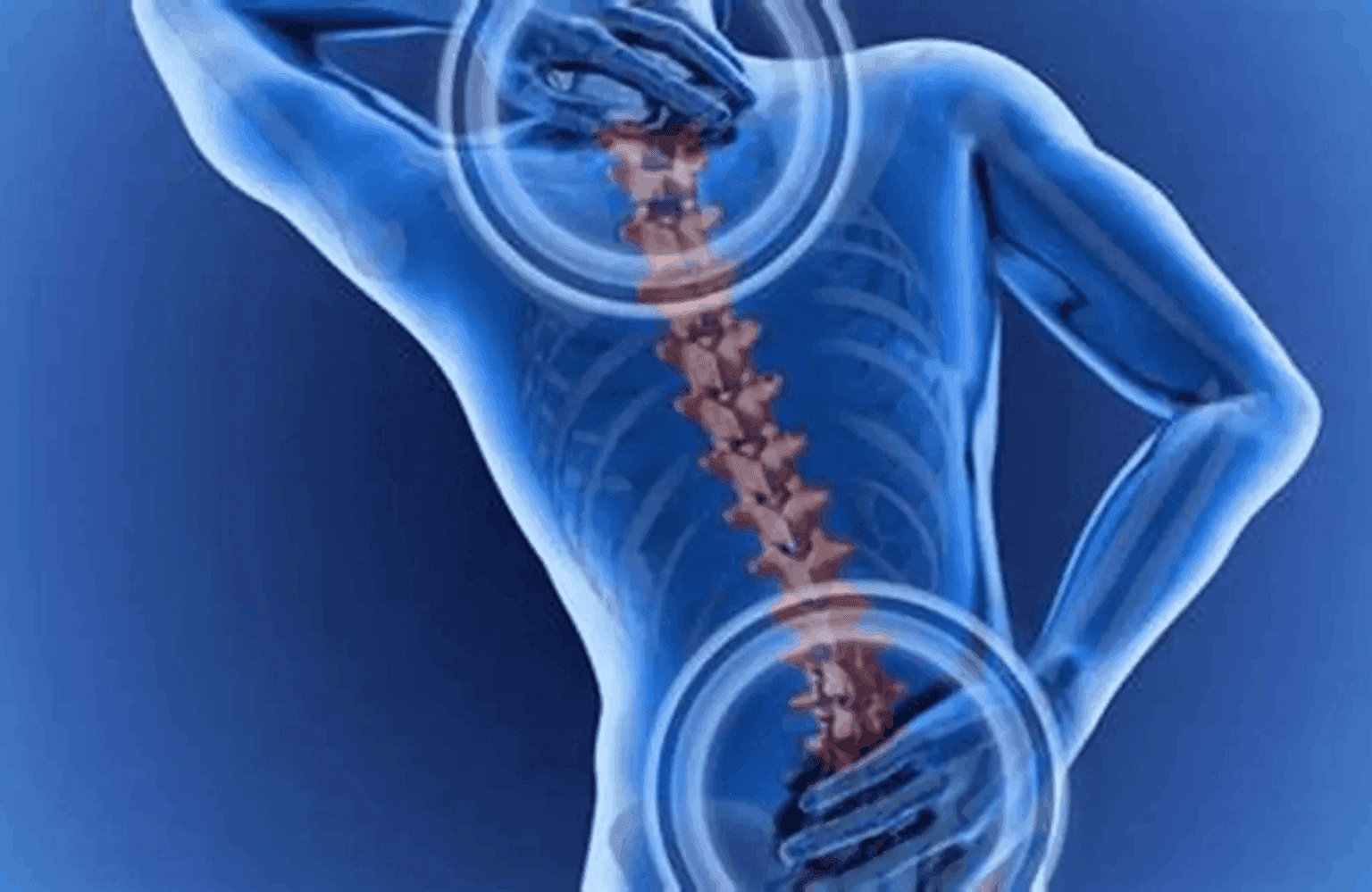 Osteoporosis Symptoms and Causes