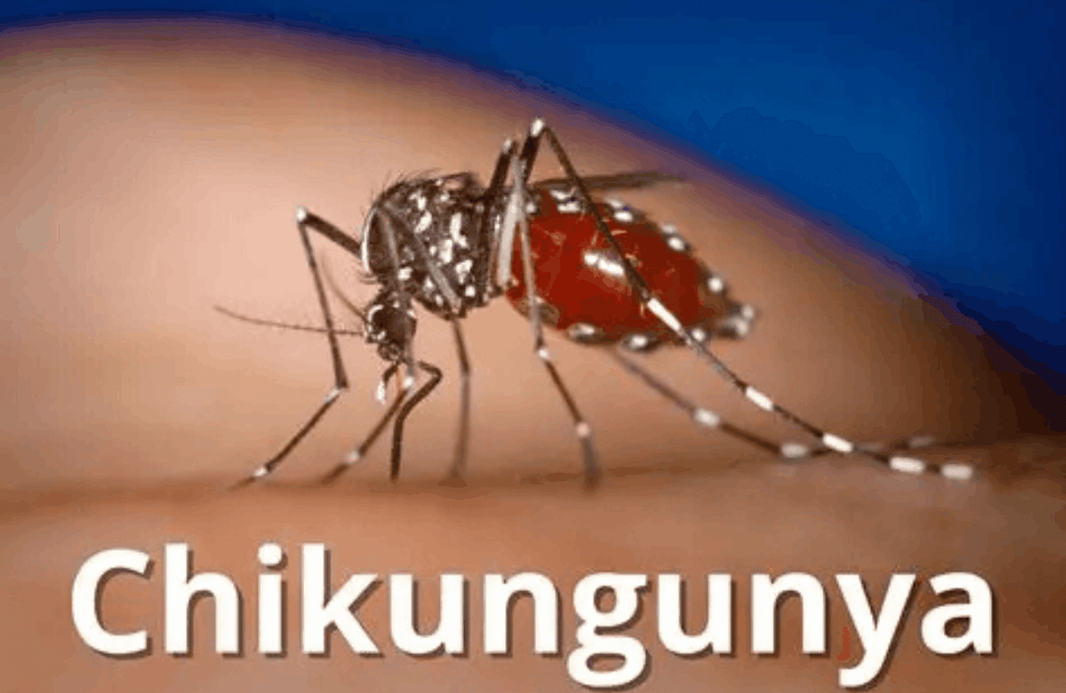 Chikungunya Symptoms and Causes