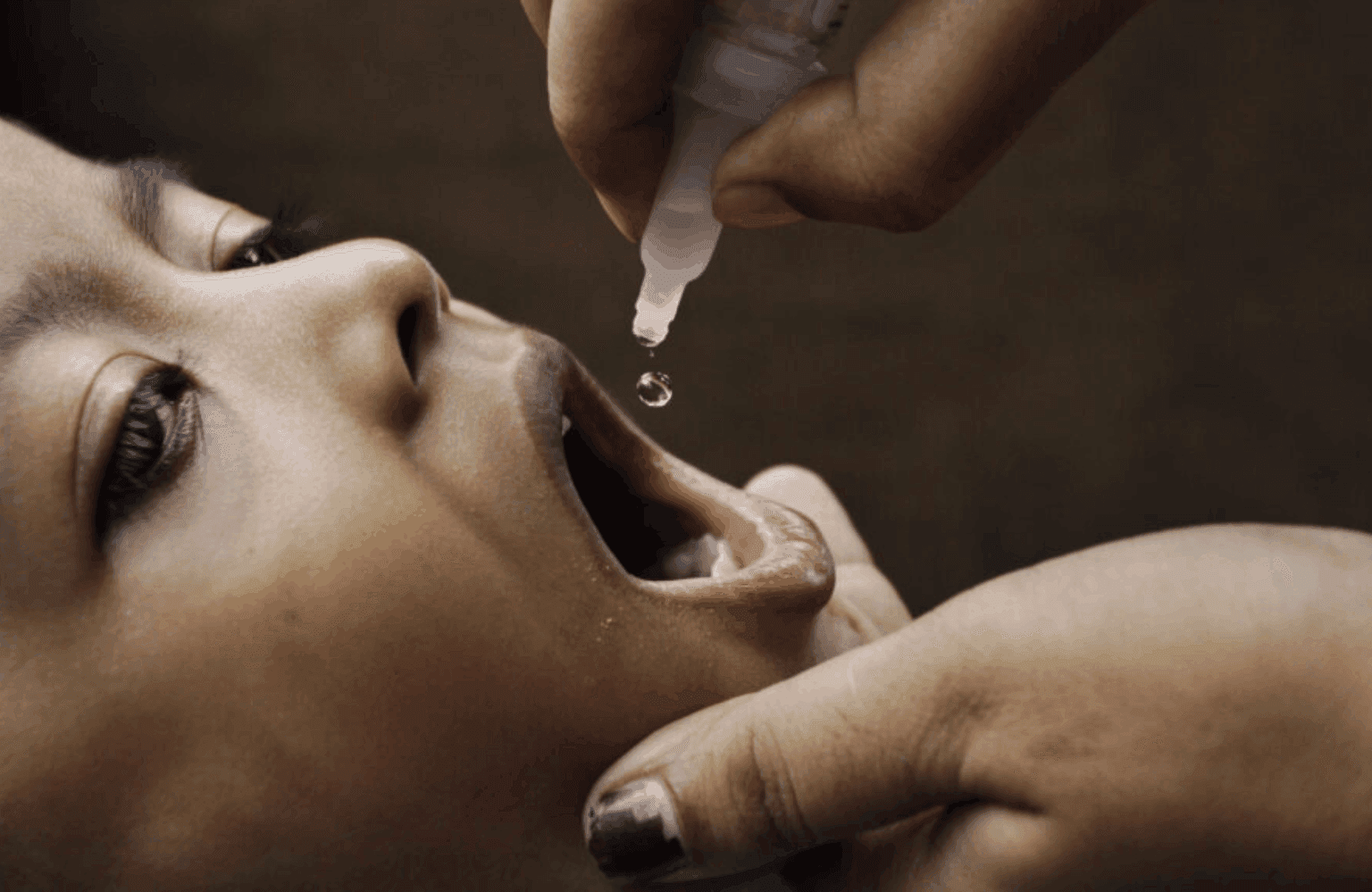 Diphtheria