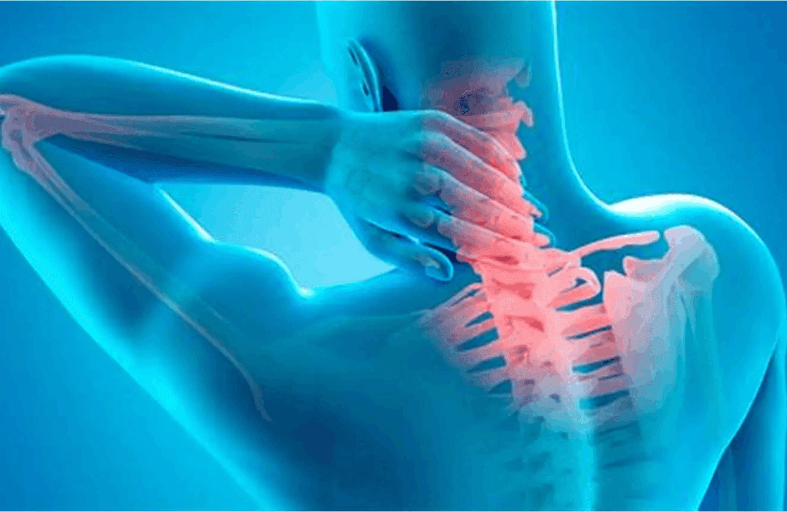 Neck pain Symptoms and Causes