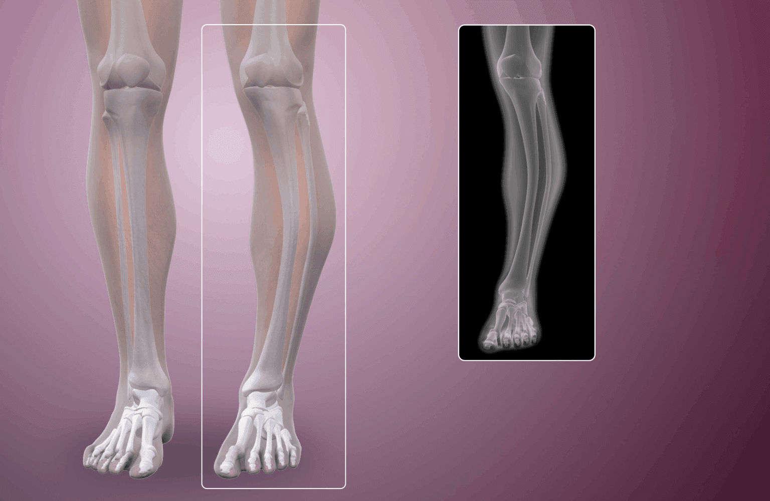 Paget's disease Causes and Symptoms
