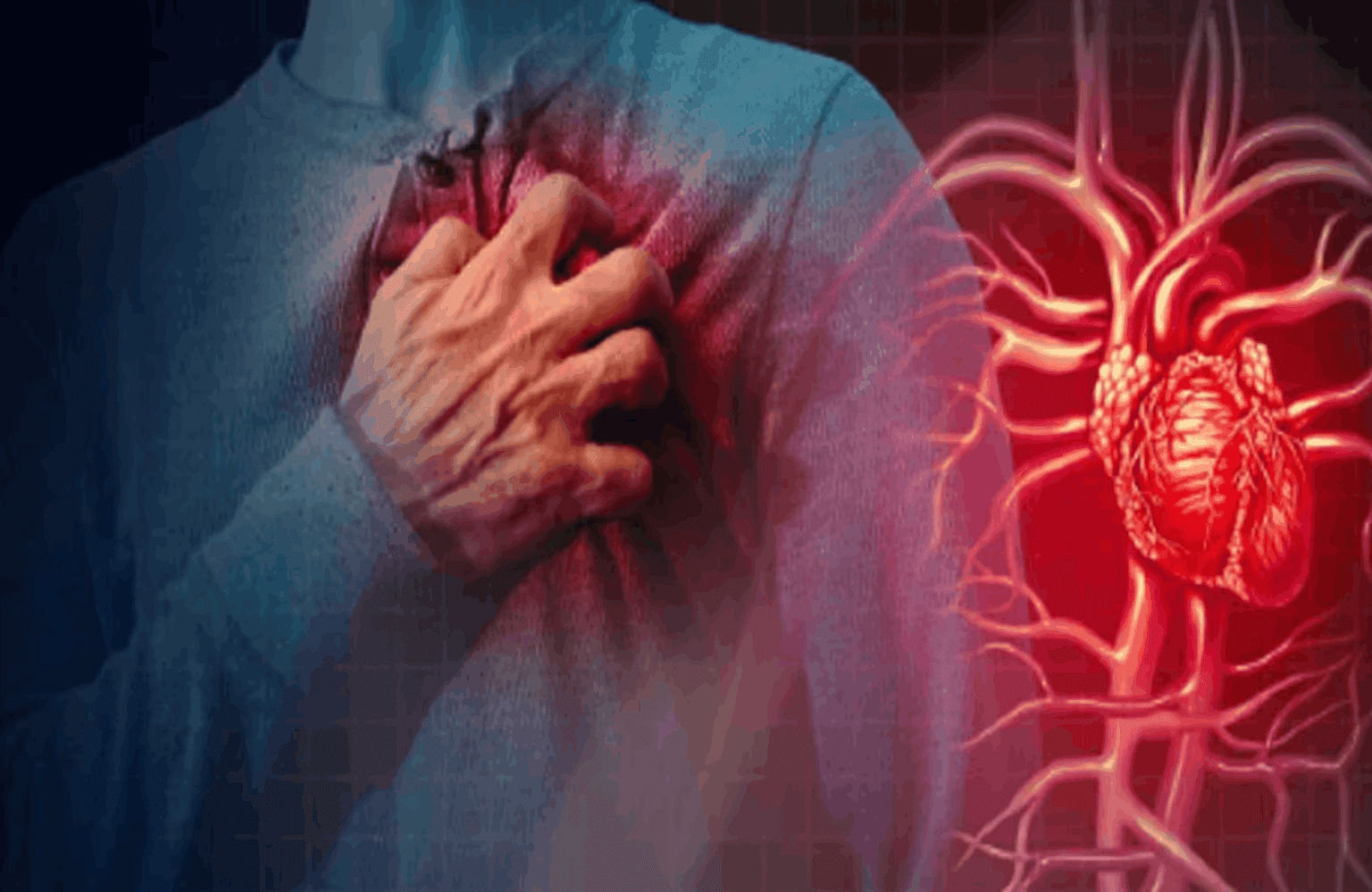 Angina