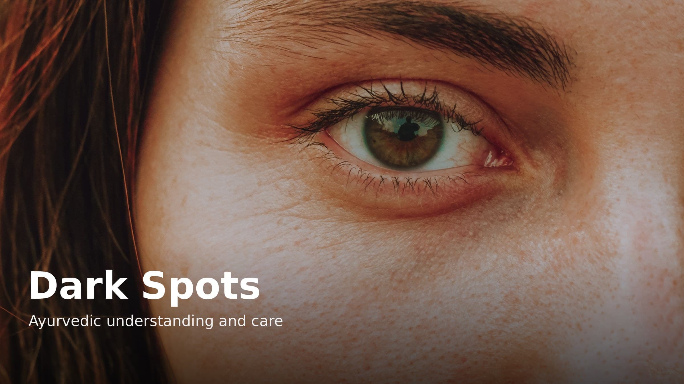 Dark Spots on Face: Causes and the Ayurvedic View