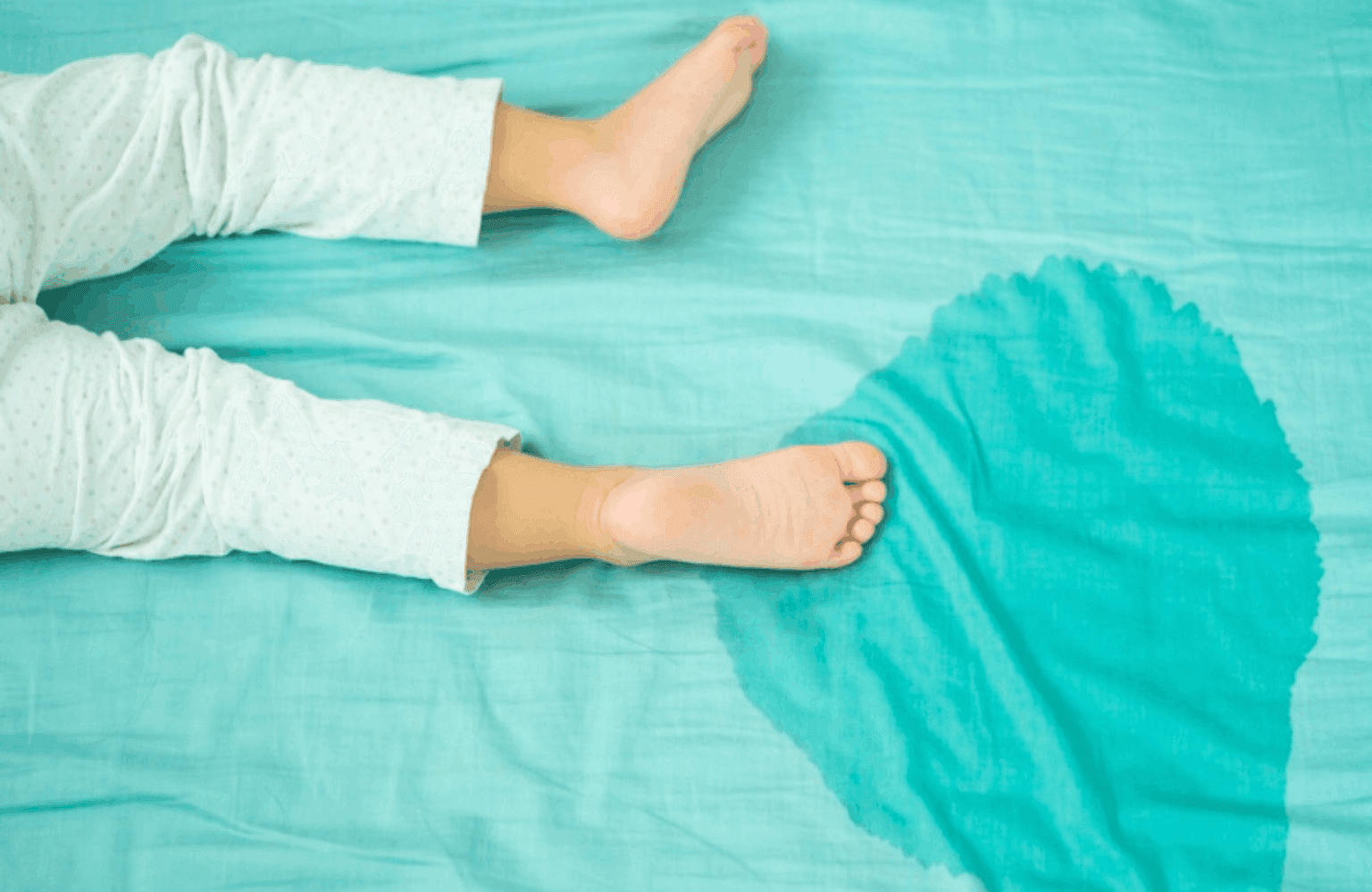 Bedwetting Causes and Symptoms