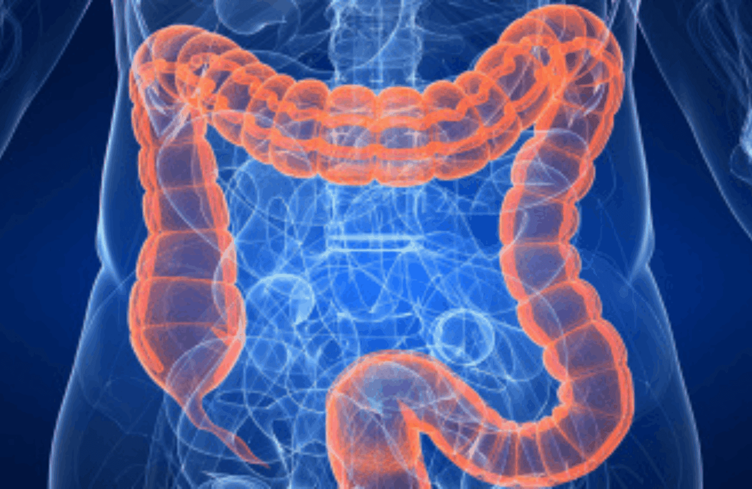 Ulcerative colitis Symptoms and Causes