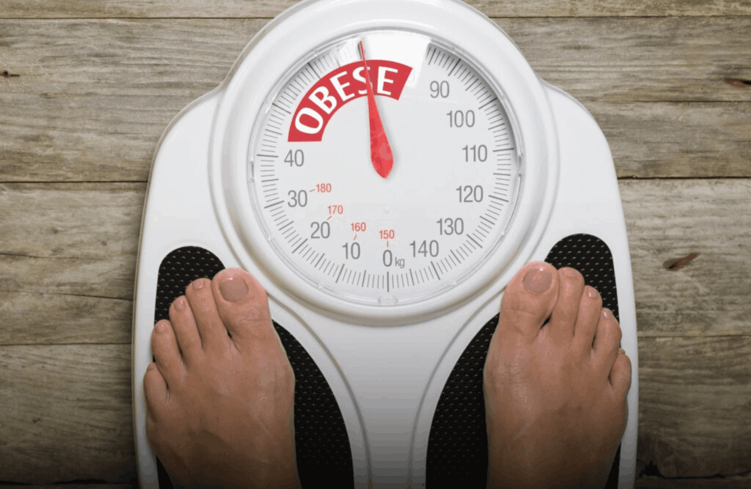 Obesity