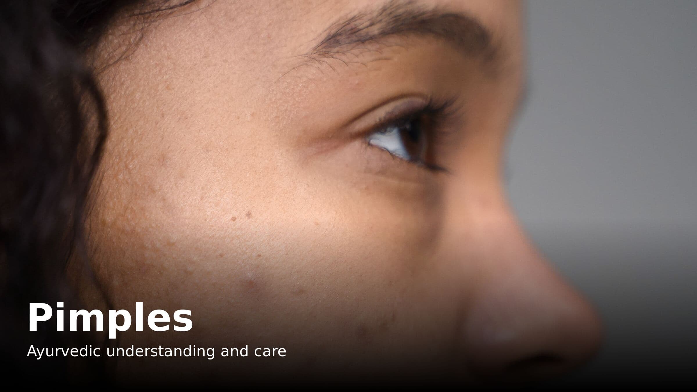 Pimples Home Remedies and the Ayurvedic View