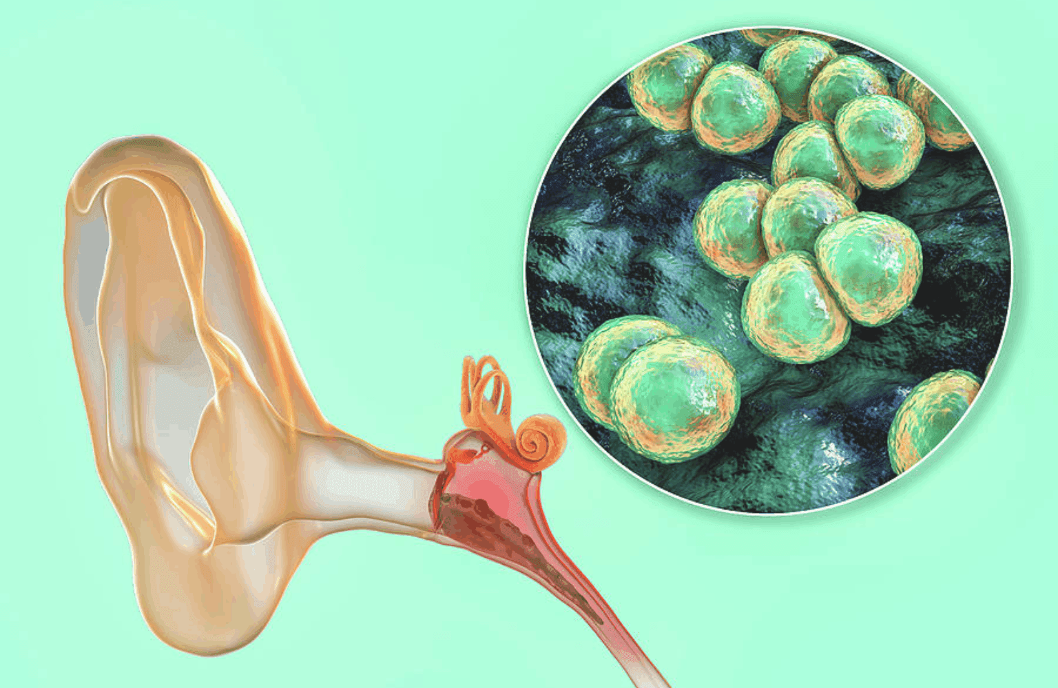 Otitis media Symptoms and Causes