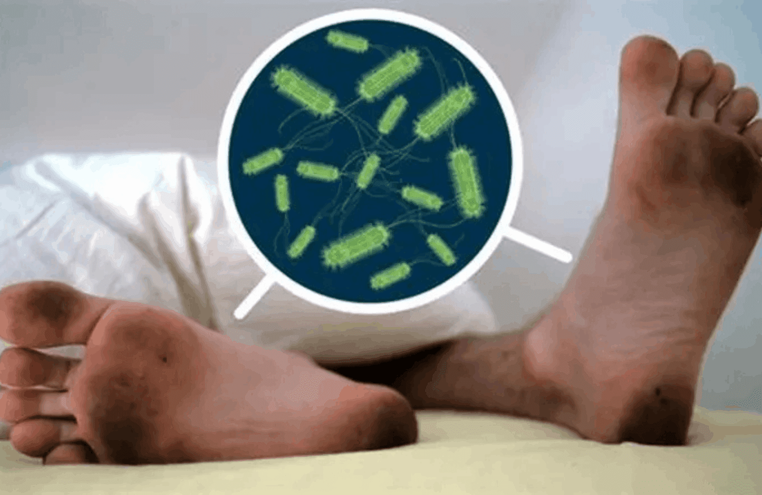 Tetanus Symptoms and Causes