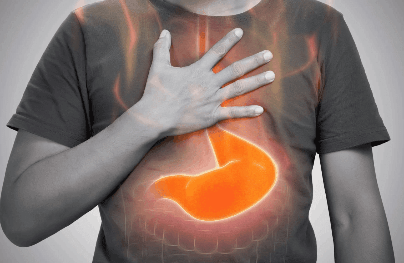 Reflux disease