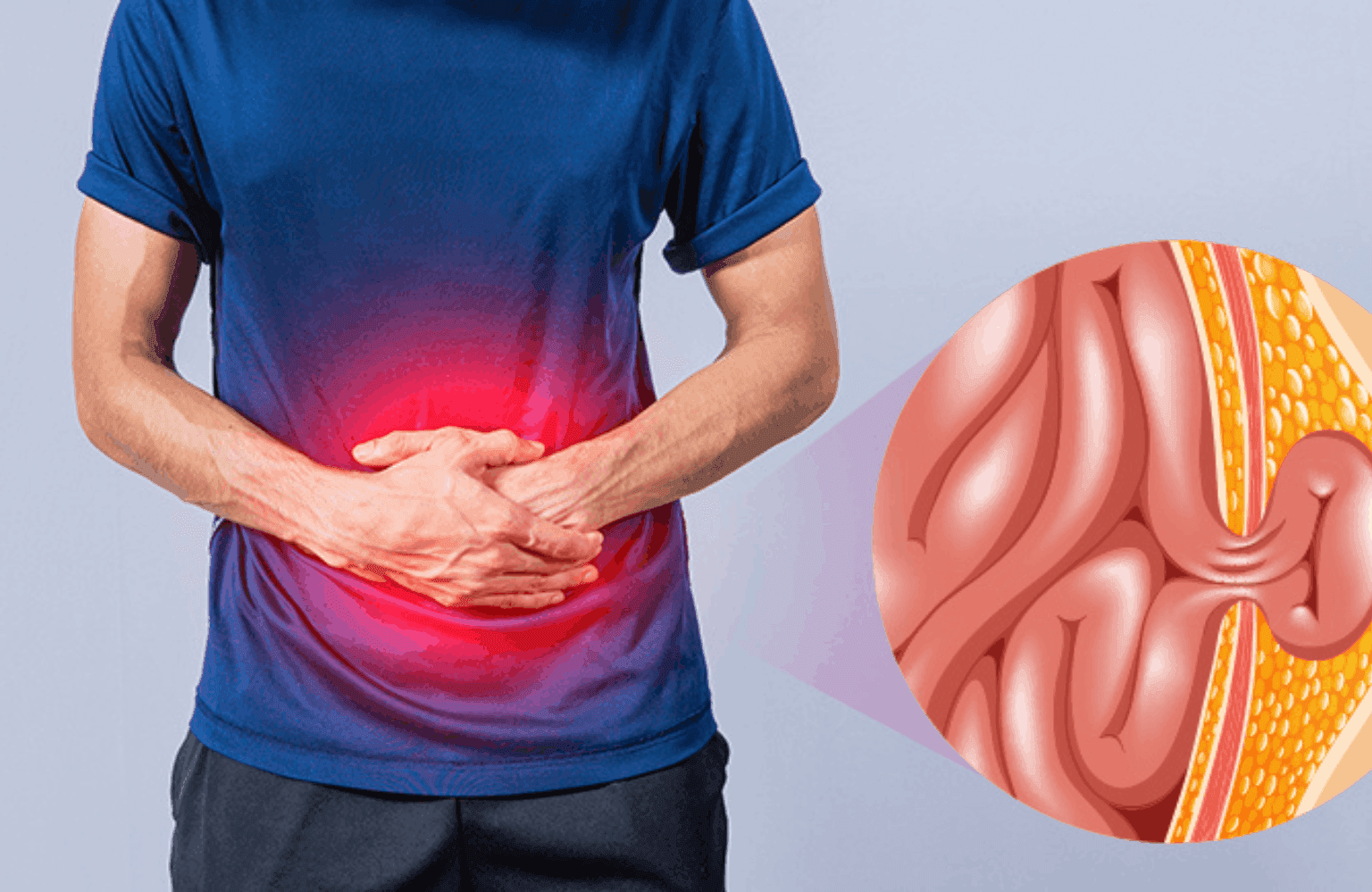 Hernia