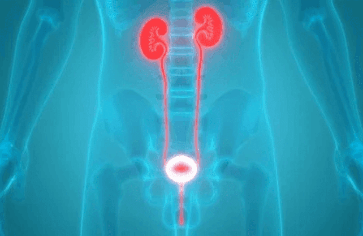 Urinary tract infection Causes and Symptoms