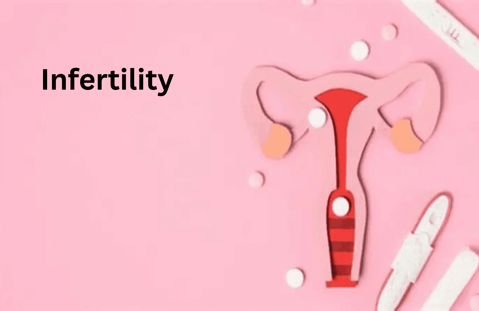 Infertility