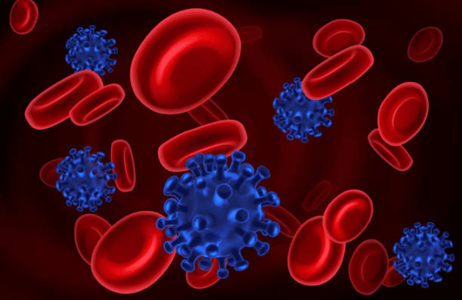 HIV infection