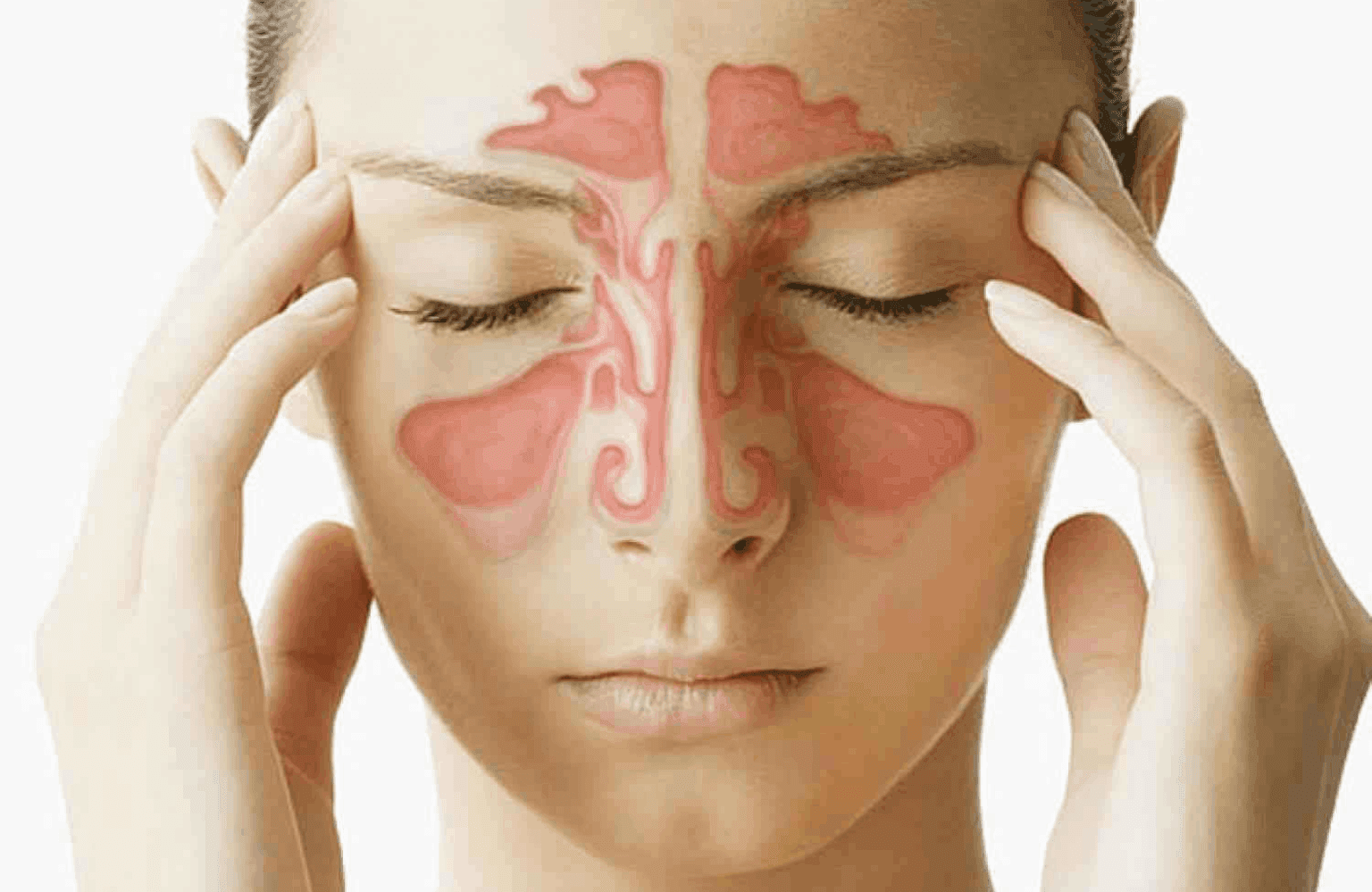Sinusitis