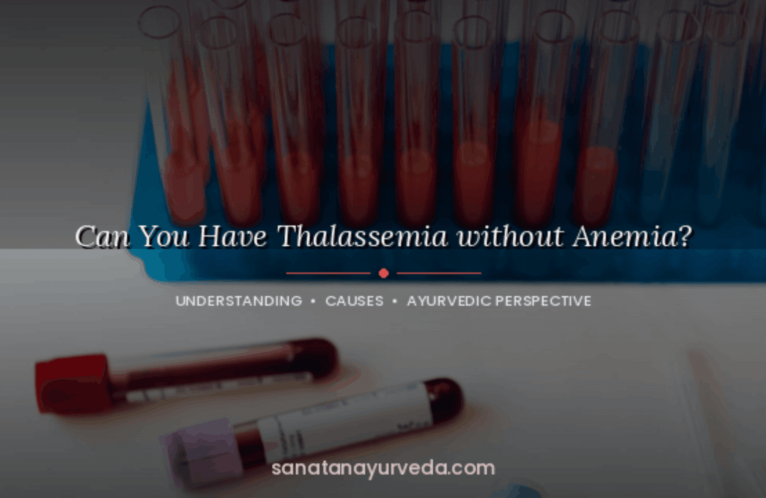 Can you have Thalassemia without Anemia